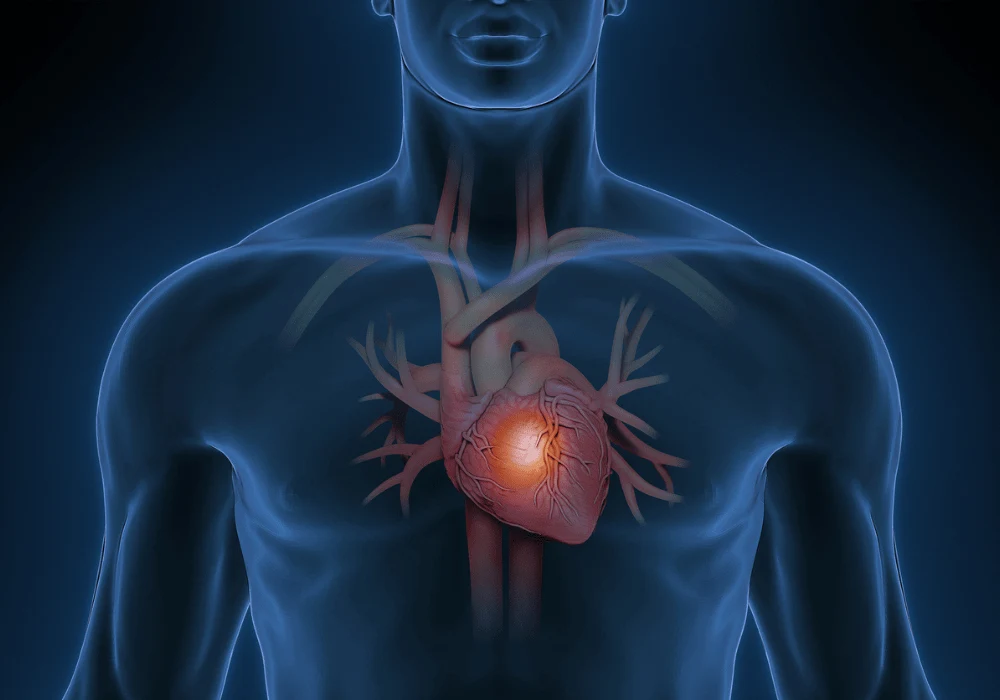 AI-Based Myocardial Scar Quantification With Cardiovascular MR