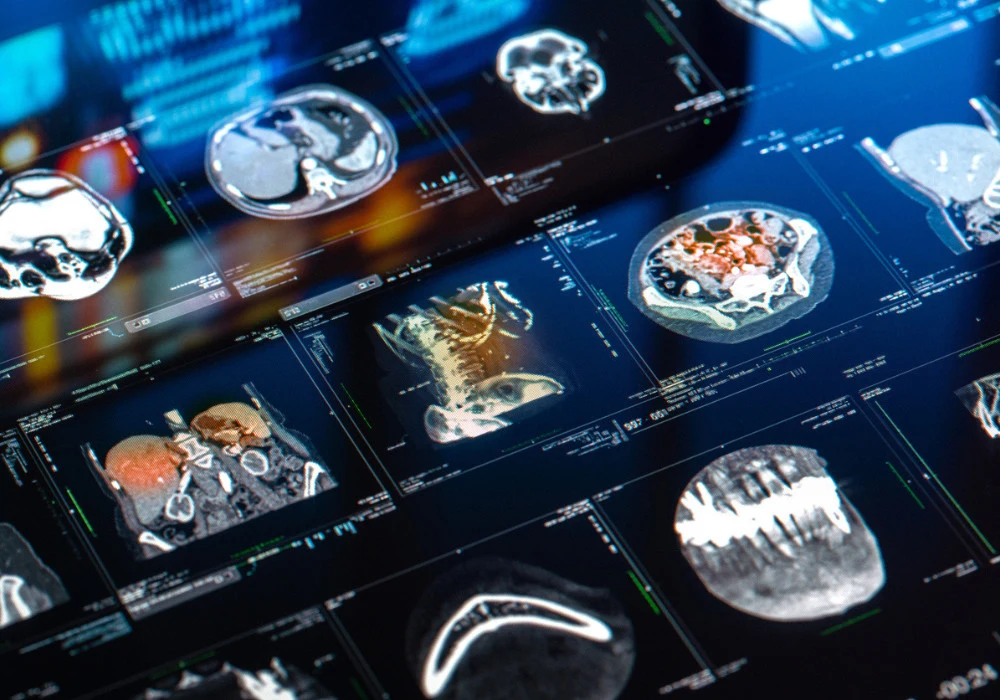 AI in Medical Imaging: Enhancing Efficiency and Overcoming Challenges
