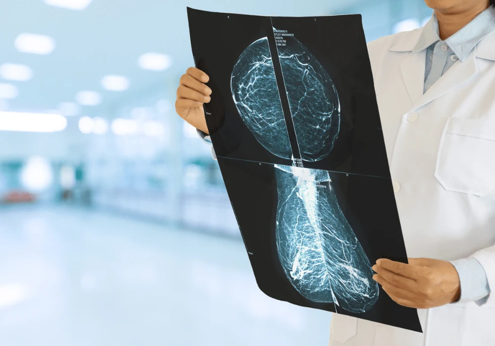 Optimising Virtual ContrastEnhanced Breast MRI with Neural Network Inputs