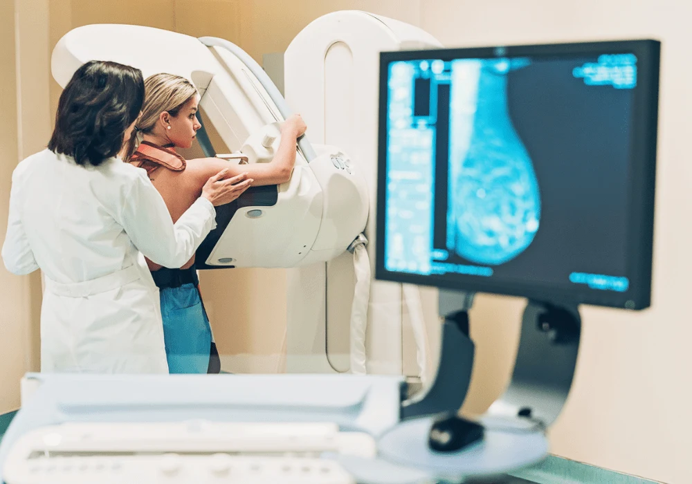 Advancing Breast Cancer Detection in MRI with AI