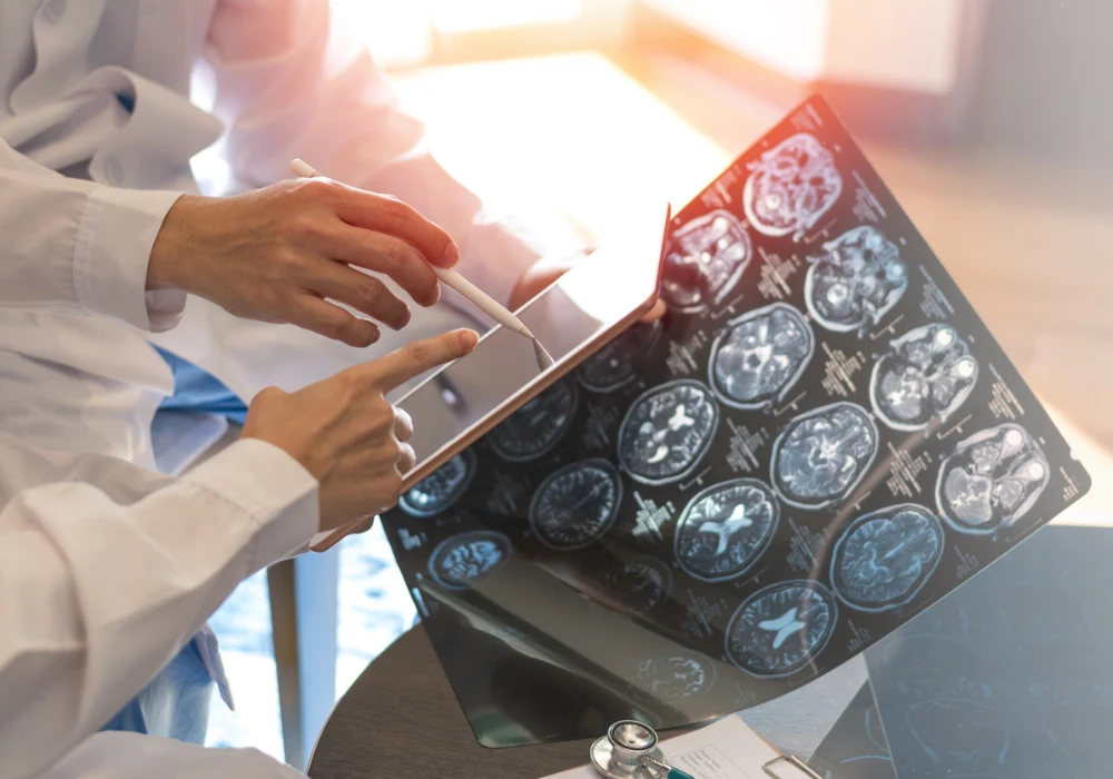 Advancing Radiology with Registration-Based Change Tracking