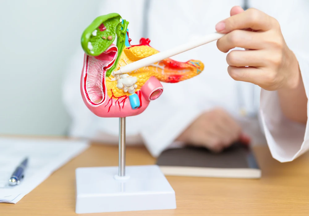 CT Radiomics and Clinical Data for Predicting Acute Pancreatitis