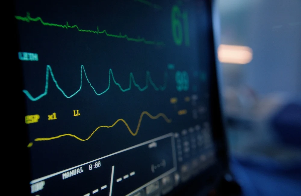 AI-Enhanced Electrocardiography to Identify Sex-Related Cardiovascular Risk