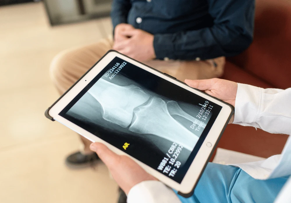 Doctor Analysing Bone X-rays on Laptop &ndash; Digital Orthopaedic Diagnosis and Patient Care&nbsp;
