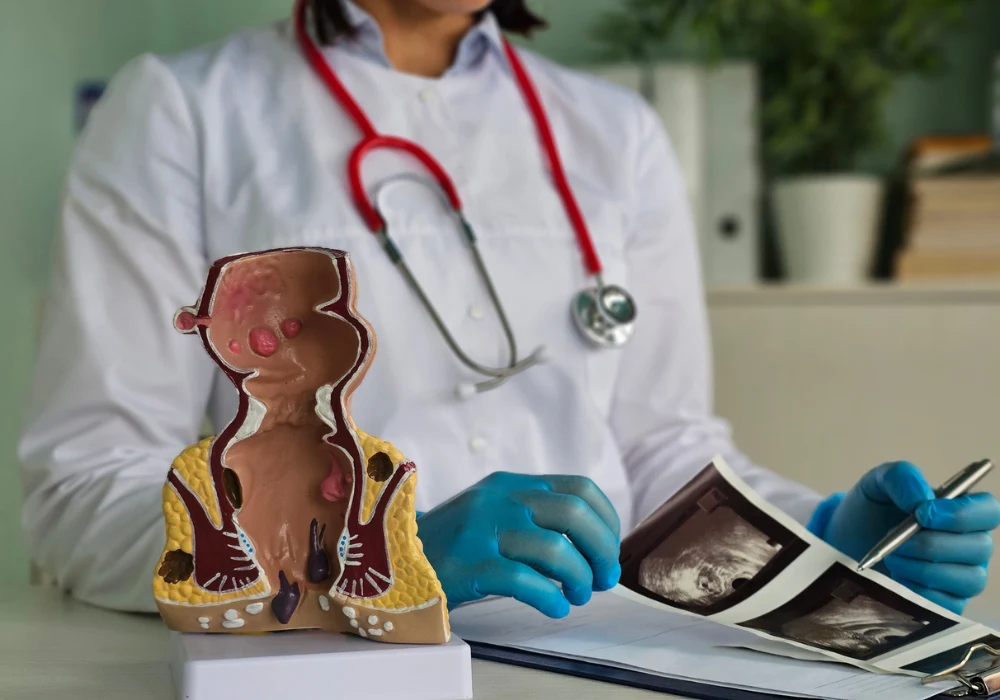 Doctor examining proctology scans with anatomical model of the rectum and anus&nbsp;