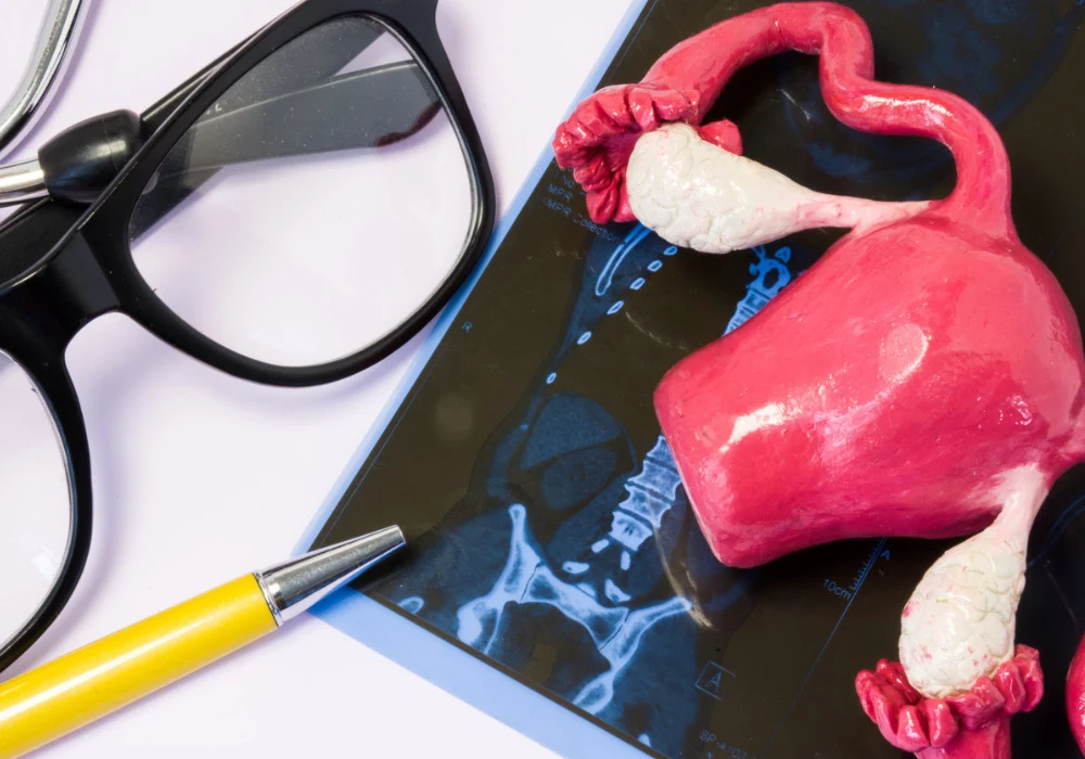 Uterus and ovaries anatomical model placed on a pelvic radiology scan, illustrating female reproductive anatomy and imaging diagnostics.&nbsp;