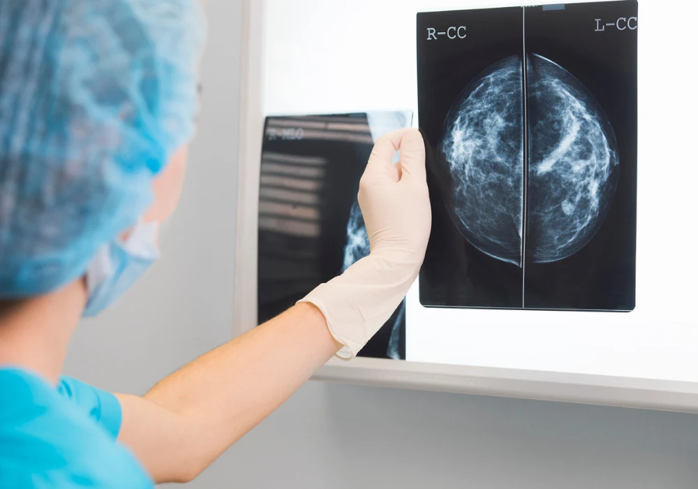 Doctor examining mammogram X-ray images for breast cancer screening and diagnosis&nbsp;