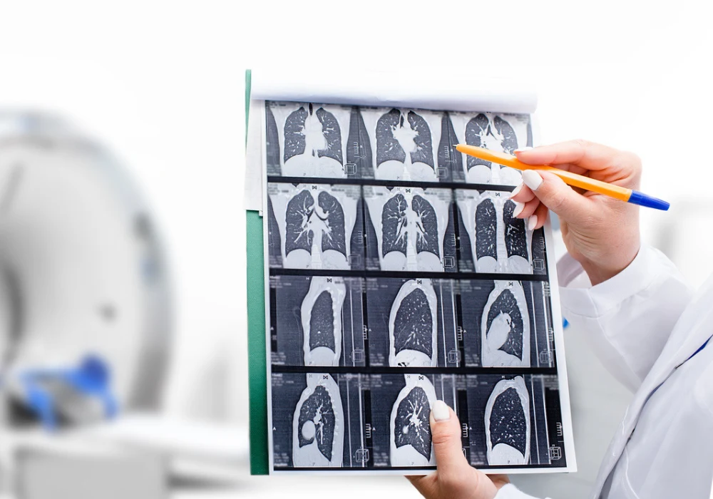 Doctor reviewing lung CT scan images for diagnosis with MRI or CT scanner in background