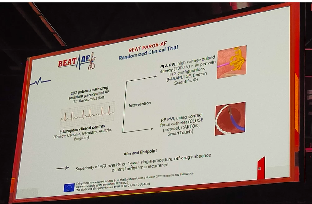 BEAT-PAROX-AF Trial: Pulsed Field Ablation vs Radiofrequency Ablation