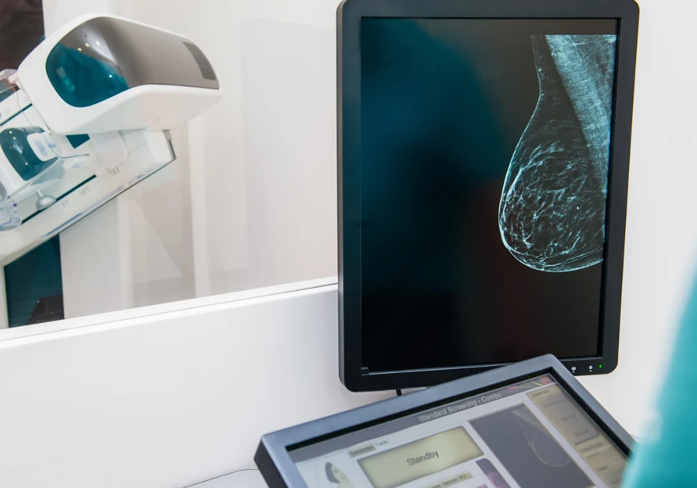 A mammography scan is displayed on a monitor, showing breast tissue imaging.&nbsp;