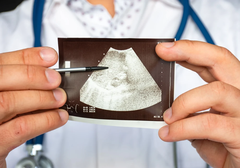 Clinician reviewing a liver ultrasound scan for non-invasive fibrosis staging in MASLD.&nbsp;