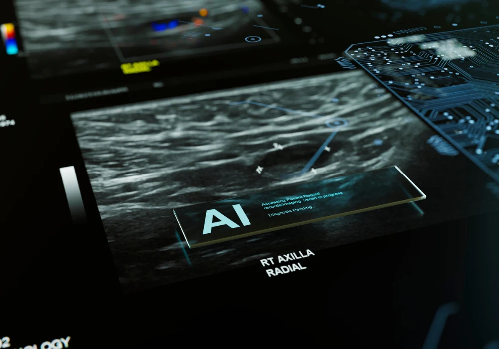 Breast ultrasound with AI decision support analysing axillary lymph nodes on a radiology workstation.&nbsp;