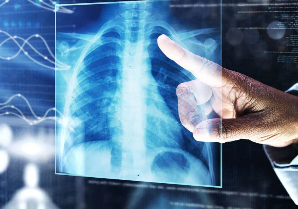 Doctor interacting with a digital chest X-ray on a transparent screen,&nbsp;symbolising&nbsp;the integration of artificial intelligence and advanced imaging technologies in modern diagnostics.&nbsp;