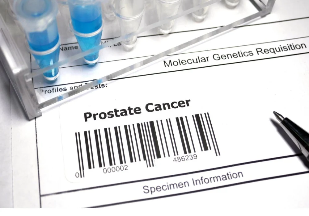 Prostate cancer testing concept with microtubes beside a requisition form labelled &ldquo;Prostate Cancer&rdquo; and a barcode.&nbsp;