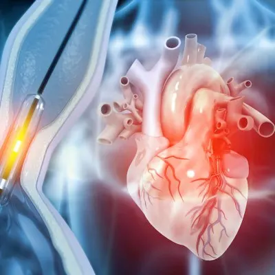 Cause and Preventability of In-Hospital Mortality After PCI