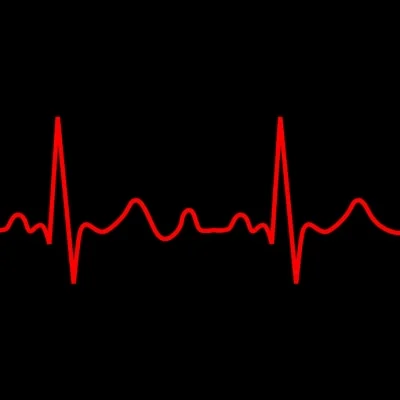 Cryocure-VT Trial - Clinical Ventricular Tachycardia