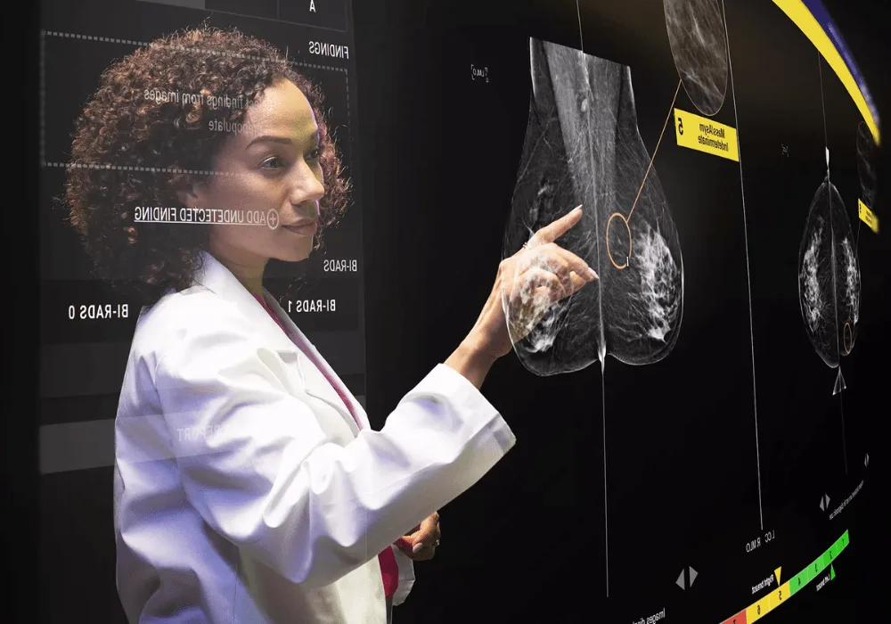 How AI is Revolutionizing Breast Cancer Detection and Saving More Lives