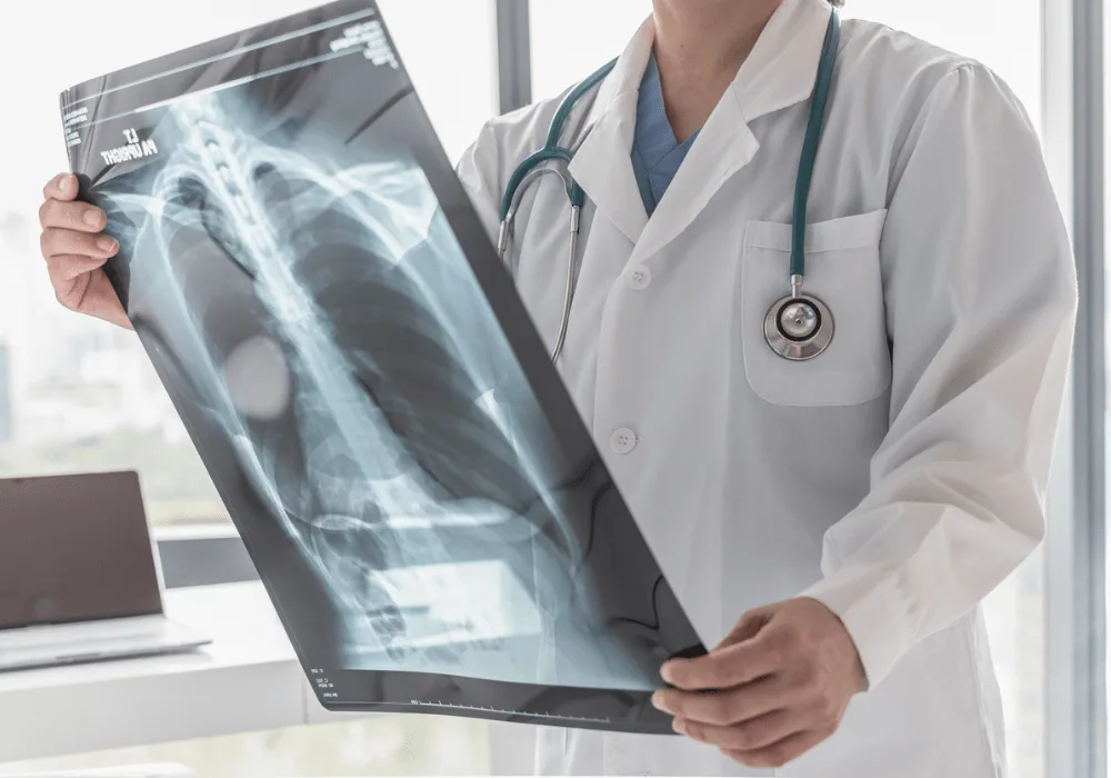 Doctor analysing chest X-ray for accurate medical diagnosis and patient care