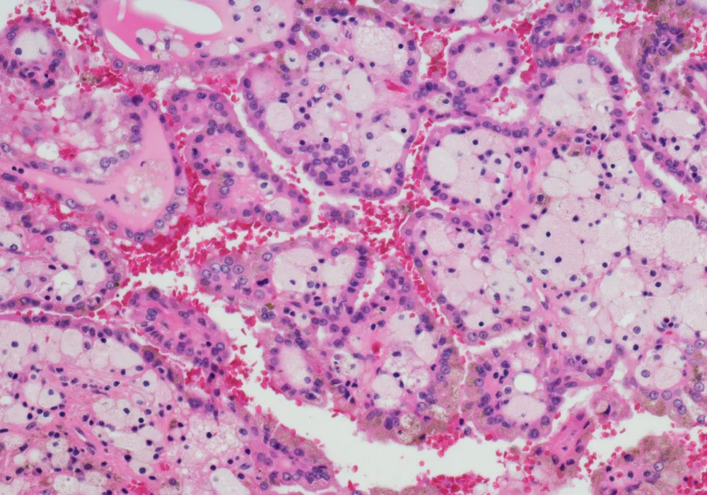 Histology slide of kidney tissue under microscope with H&amp;E stain showing renal structures&nbsp;