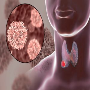 Enhancing Thyroid Nodule Characterisation: A CT-Based Radiomics Approach