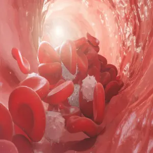 Temporal Artery Ultrasound Avoids Biopsy for Giant Cell Arteritis