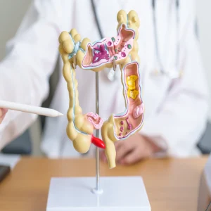 Radiomics Model for Advancing Tumour Budding Assessment in Rectal Cancer 