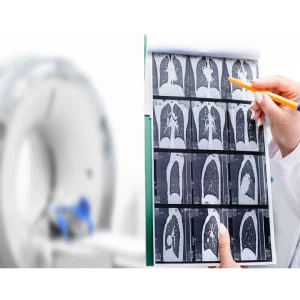 Radiologist reviewing CT lung scan images in front of CT scanner for chest disease and lung cancer diagnosis.&nbsp;