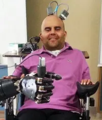 Patient with neural prosthetic device 