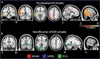 Axial and sagittal MR images 