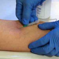 Patient&#039;s arm with blood being taken