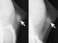 microcalcifications in normal mice (left) and those with dense breast tissue