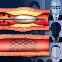 Patient Selection for PCI