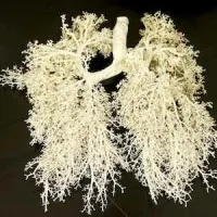 Plasticised set of lungs