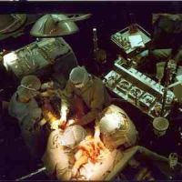 Coronary Artery Bypass Grafting Surgery 