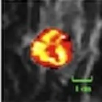 Differences in dynamic textural patterns are apparent between a patient with a low recurrence score and a patient with a high recurrence score