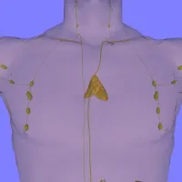 Photo: Anterior view of chest showing location and size of adult thymus (Source: https://commons.wikimedia.org/wiki/Main_Page)