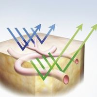 Narrow Band Imaging (source: Olympus Medical Systems)