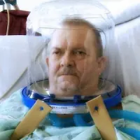 Patient receiving helmet-based ventilation (image credit: University of Chicago Medical Center)