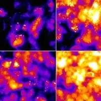 Cancer scan, credit Cancer Research UK