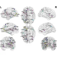 DTI Reveals Brain Network Disruption in Children with PTSD