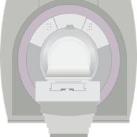 MRI in Pulmonary Embolism Diagnosis