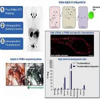 Technology of dual-labeled PSMA-inhibitors for PET/CT imaging and fluorescence-guided intraoperative identification of metastases. This work might help to establish a new treatment regimen for more precise and sensitive pre-, intra- and post-therapeutic d