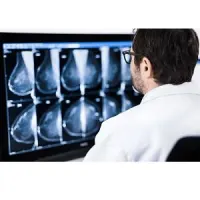 Sectra to deliver nationwide imaging IT solution to Dutch breast screening program