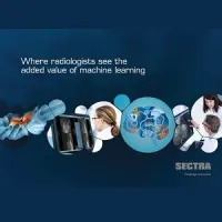 New report from Sectra shows where radiologists see the added value of machine learning