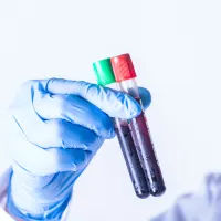 Blood Cultures Before Sepsis Treatment