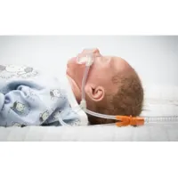 Nuflow&reg; Nasal Cannulas for HFOT in Neonates