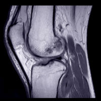 Focus on Sports Imaging for International Day of Radiology