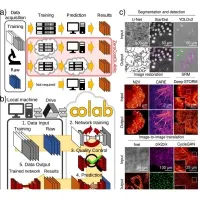 AI for Microscopy Images