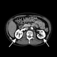 Contrast Agent Shortage Sends Ripples through Radiology