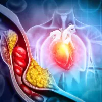 New Approach to Design Cholesterol-Lowering Therapies 